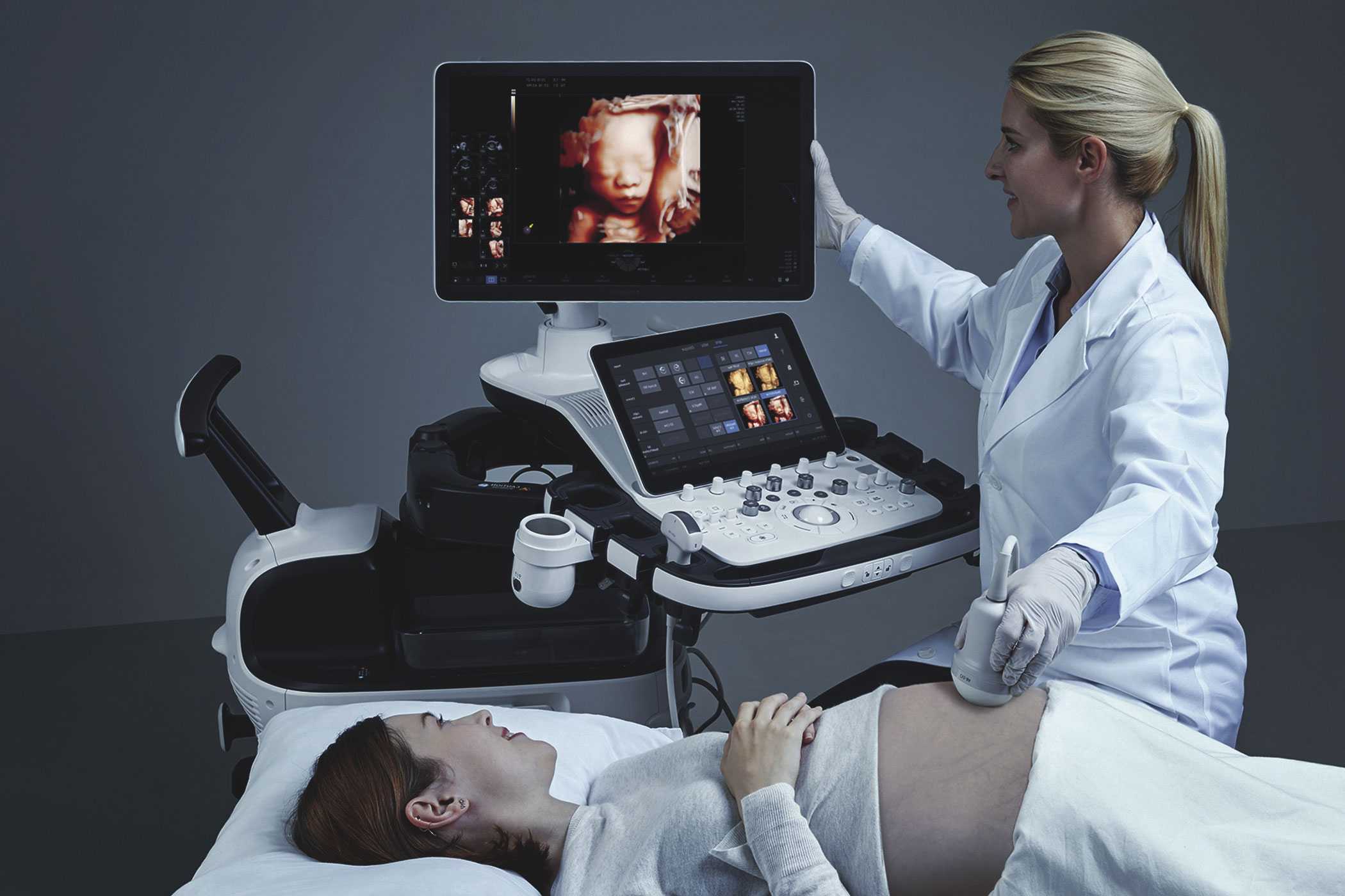 В год какие узи делают. Аппарат УЗИ. УЗИ. Ультразвуковые сканеры гинекологии.