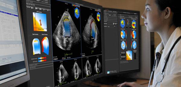 Echocardiography_cardiac_ultraound_PR%20