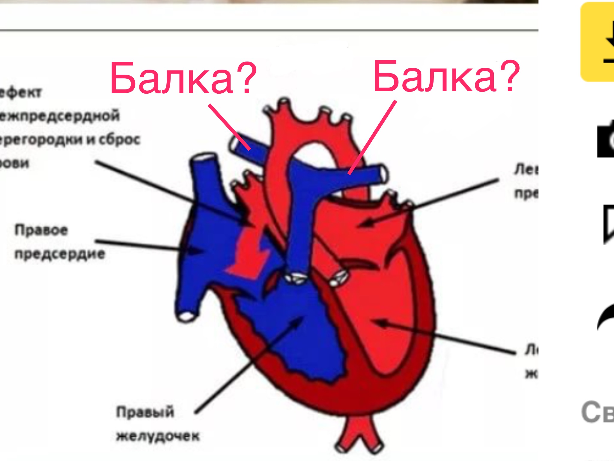 Презентация на тему перегородки