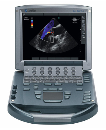 УЗИ сканер SonoSite M-Turbo