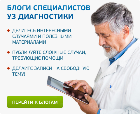 Блоги специалистов УЗД