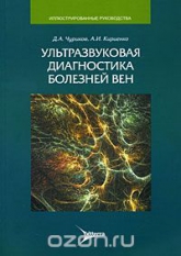 Ультразвуковая диагностика болезней вен