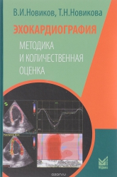 Эхокардиография. Методика и количественная оценка