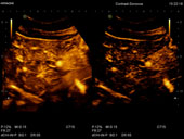 Contrast harmonic Imaging