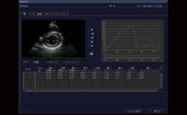 2D Tissue Tracking