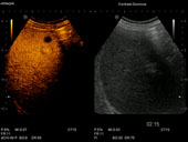 Contrast harmonic Imaging