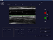 IMT measurement