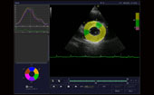 Color Tissue Tracking