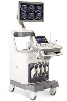 Accuvix A30