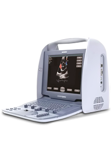 Acuson Cypress Plus