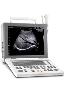 SonoAce R3