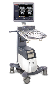Voluson S6