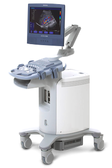 Acuson X150