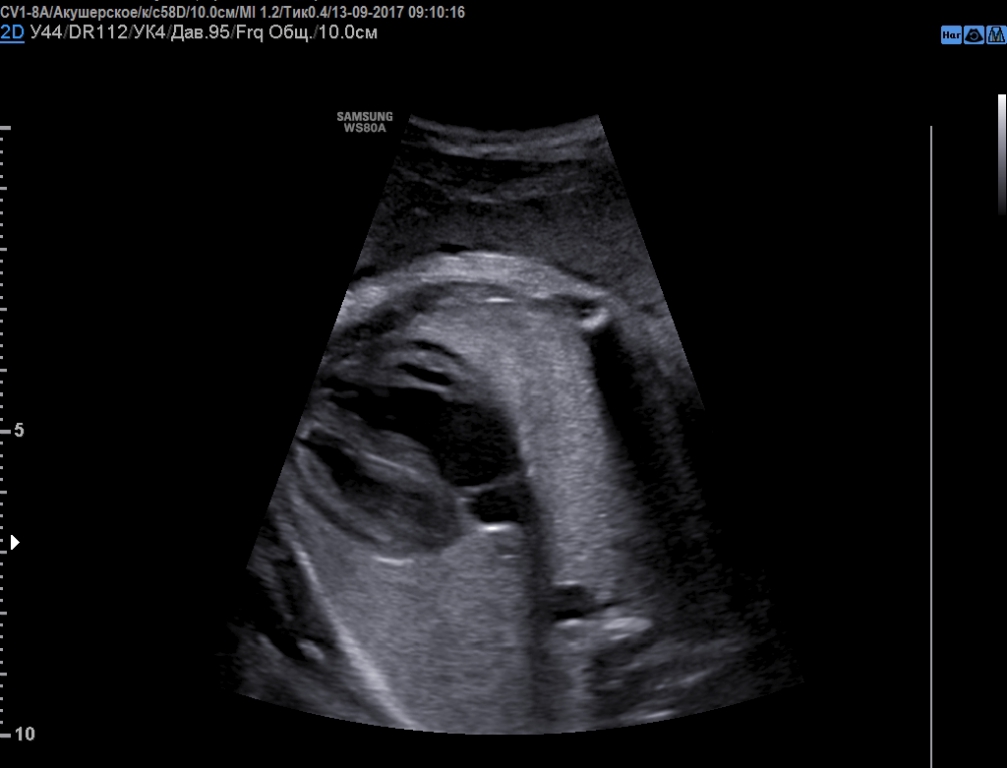 Книги По Узи В Педиатрии