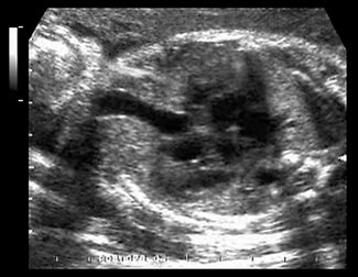 sm634242225172500000.jpg