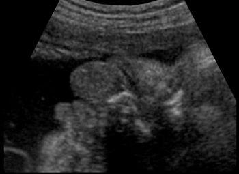sm634250355778593750.jpg