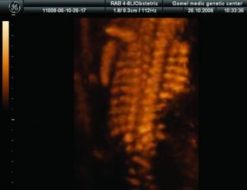sm634250398175625000.jpg