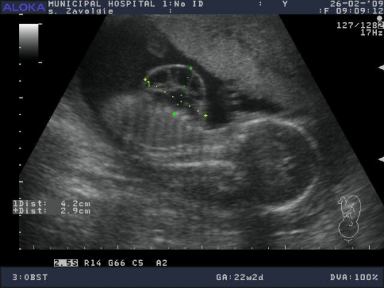 120130-28.JPG