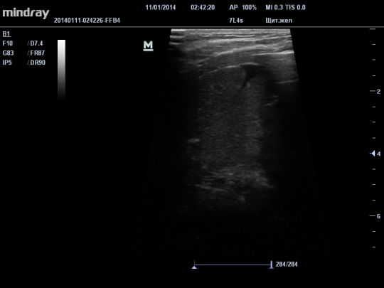 201401110242320001SMP.JPG