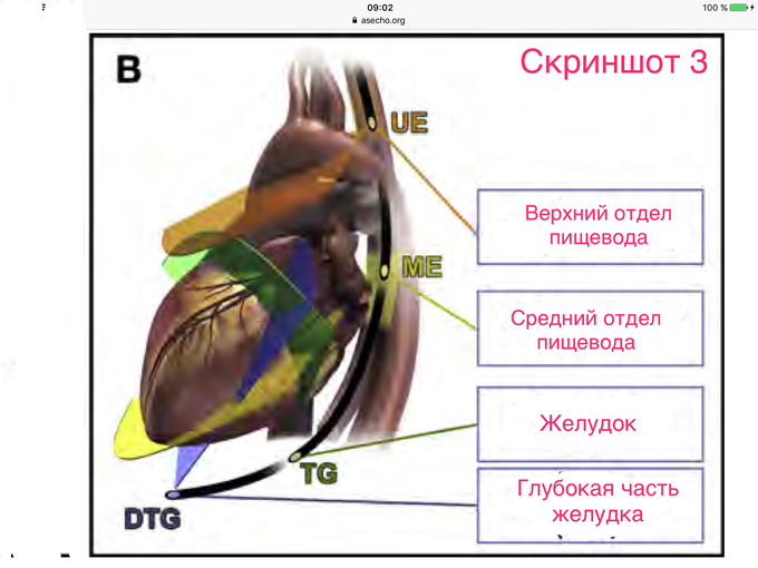 Чп эхо кг исследование что это и подготовка к нему. Смотреть фото Чп эхо кг исследование что это и подготовка к нему. Смотреть картинку Чп эхо кг исследование что это и подготовка к нему. Картинка про Чп эхо кг исследование что это и подготовка к нему. Фото Чп эхо кг исследование что это и подготовка к нему