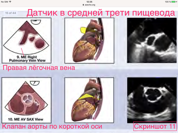Чп эхо кг исследование что это и подготовка к нему. Смотреть фото Чп эхо кг исследование что это и подготовка к нему. Смотреть картинку Чп эхо кг исследование что это и подготовка к нему. Картинка про Чп эхо кг исследование что это и подготовка к нему. Фото Чп эхо кг исследование что это и подготовка к нему
