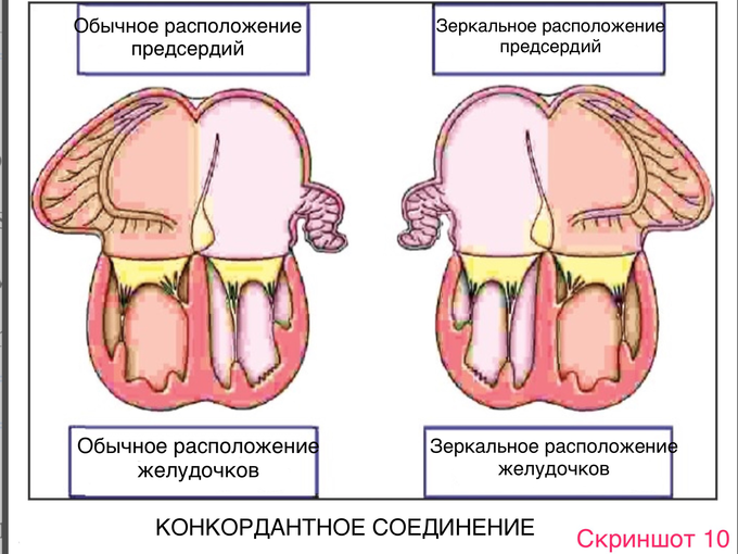 Что такое situs solitus. Смотреть фото Что такое situs solitus. Смотреть картинку Что такое situs solitus. Картинка про Что такое situs solitus. Фото Что такое situs solitus
