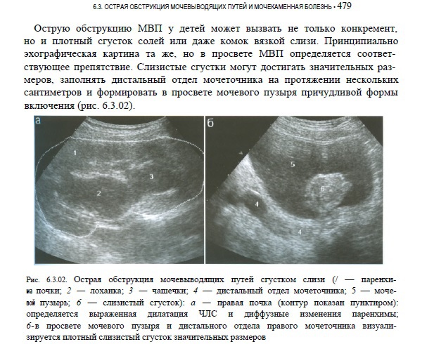 Признаки диффузных изменений обеих почек