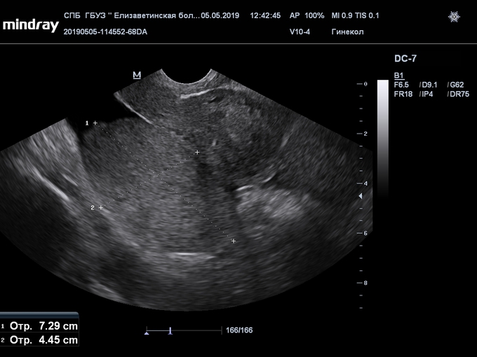 201905051243000012GYN.JPG